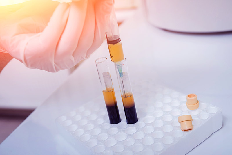 PRF Anti-Aging Treatments